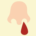 鼻血の塊が出た！レバー状だけど原因は何でしょうか？
